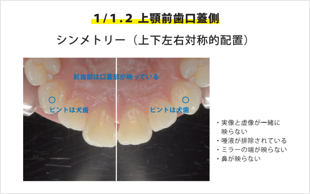 口腔内規格写真